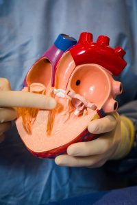 PeaceHealth-Mi traClip-CathLab-Heart-Cross-Section-2021