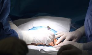 a doctor performing hernia surgery