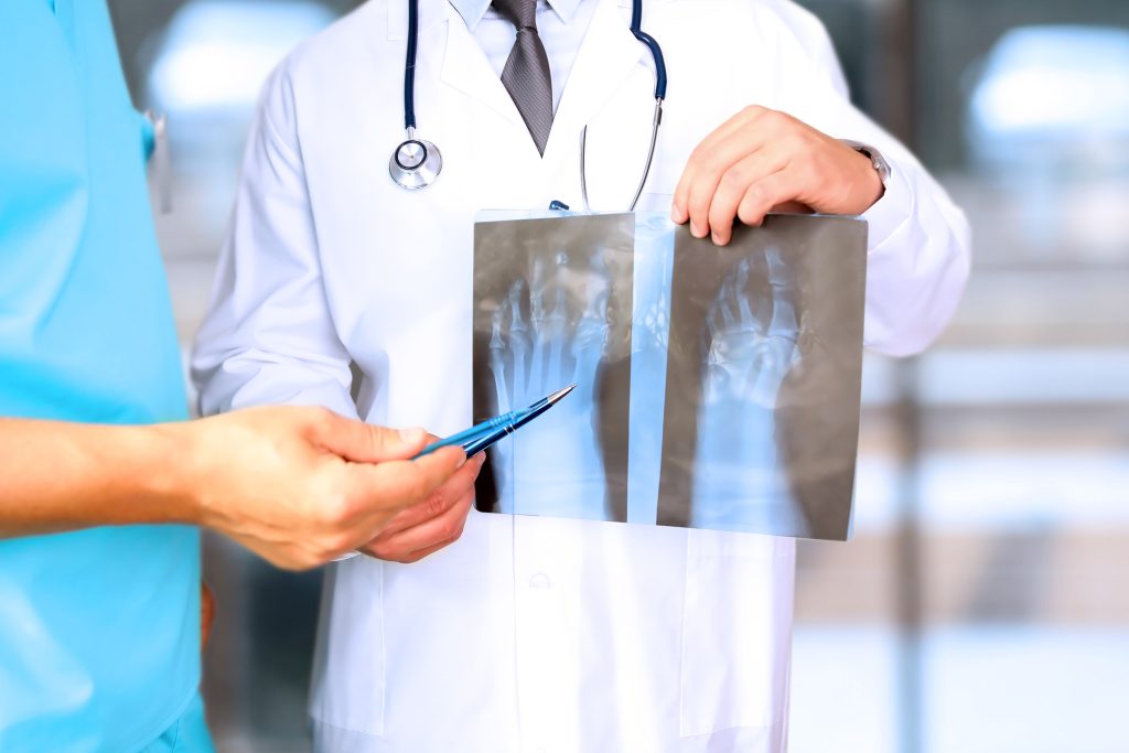 doctor holding up an xray and pointing to it with the pen