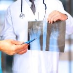 Male doctors looking at x-ray of foot